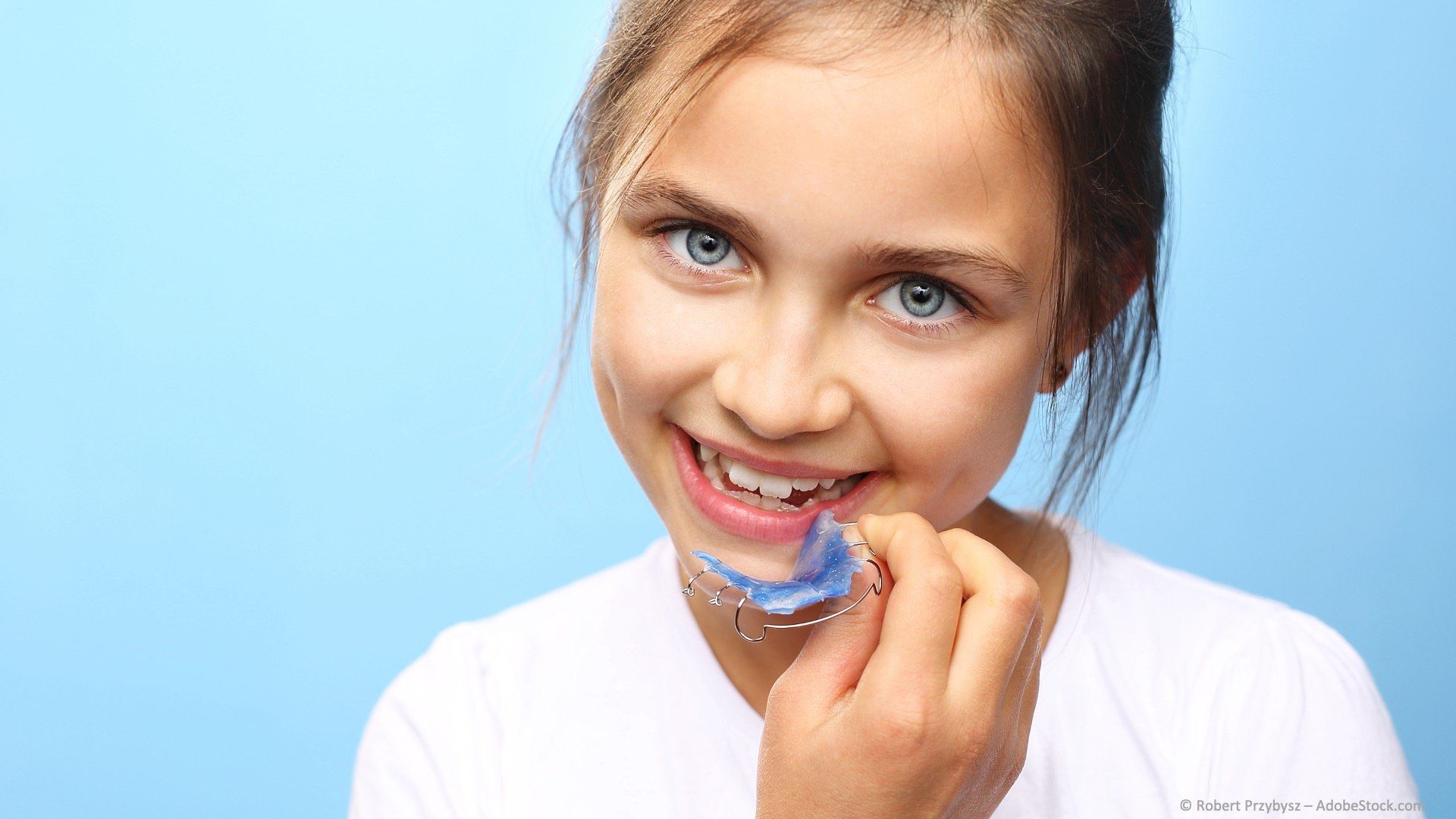 Tipps zur Tragedauer von herausnehmbaren Zahnspangen