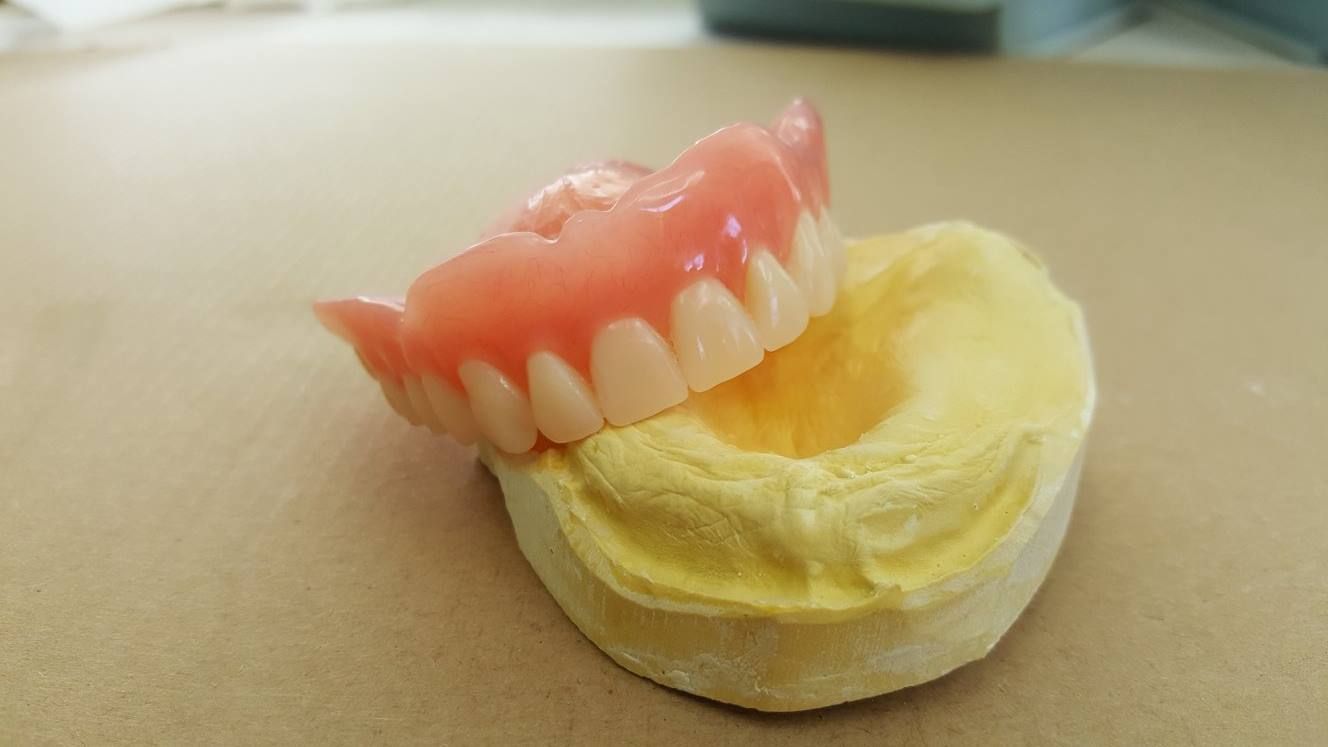 A model of a denture is sitting on a table.