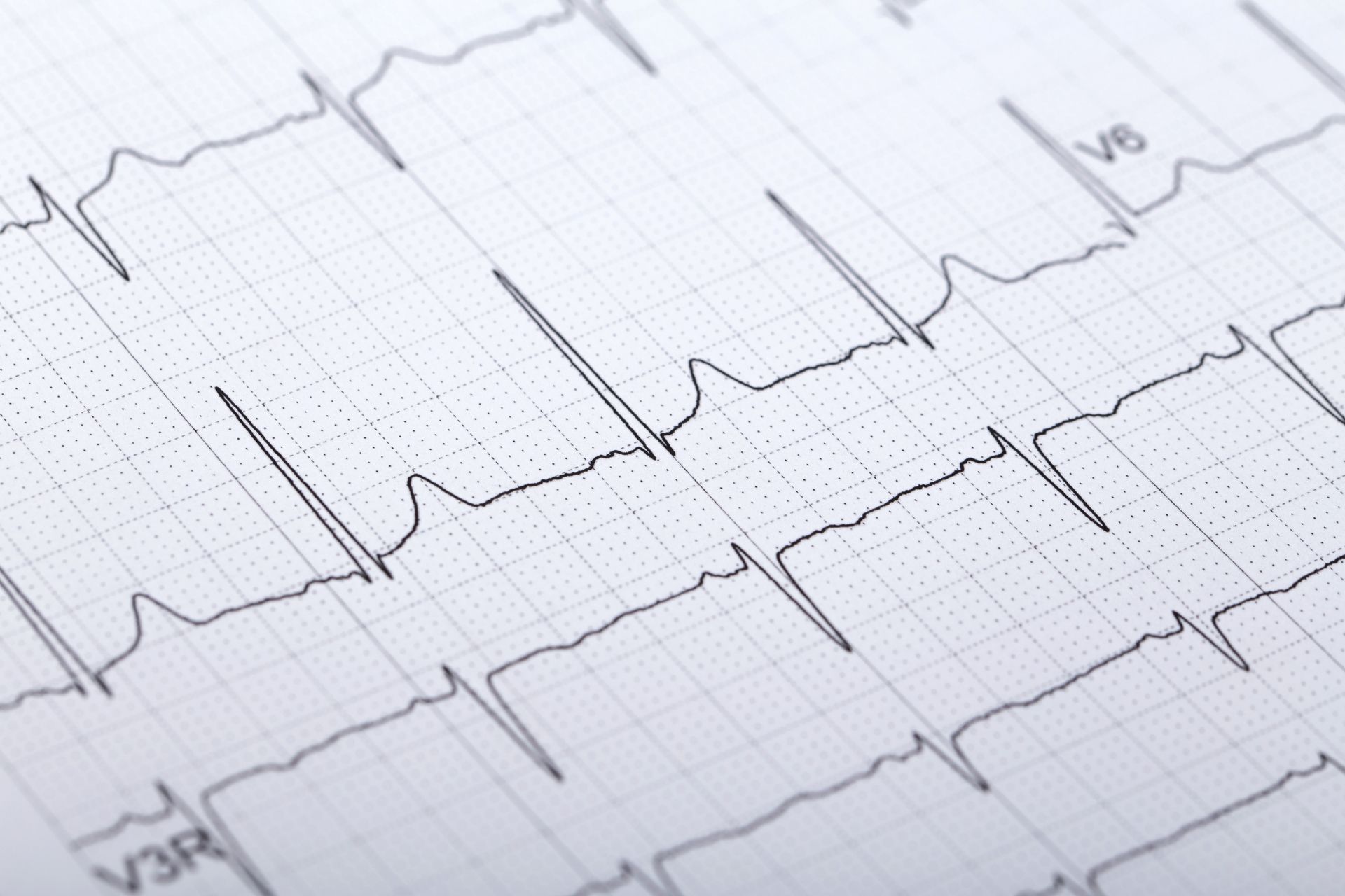 A close-up view of a medical electrocardiogram (ECG) tracing showing a rhythmic heart beat on paper grid lines. A close-up view of a medical electrocardiogram (ECG) tracing showing a rhythmic heart beat on paper grid lines.