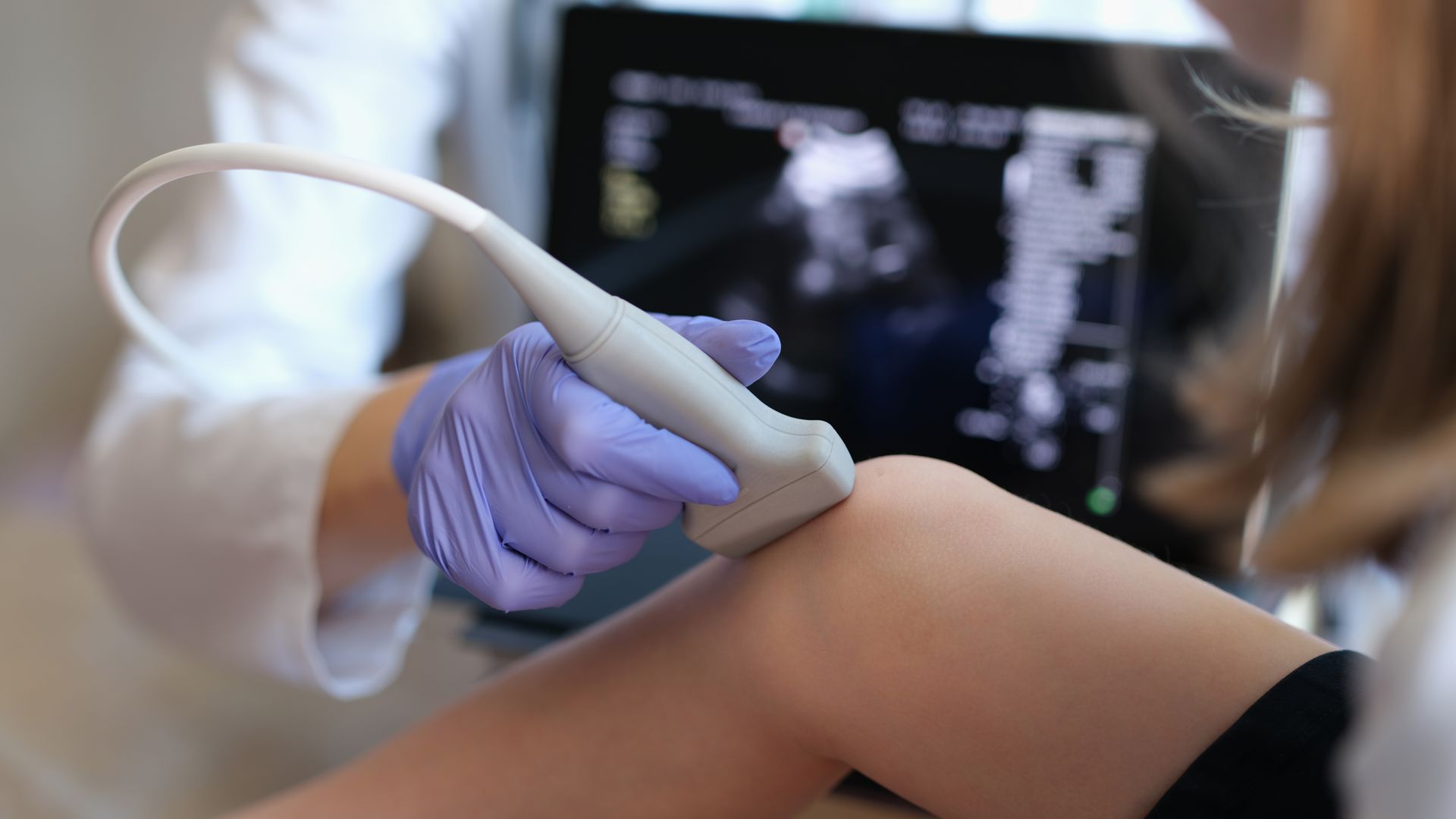 A medical professional in blue gloves performs an ultrasound scan on a patient's knee. A medical professional in blue gloves performs an ultrasound scan on a patient's knee.
