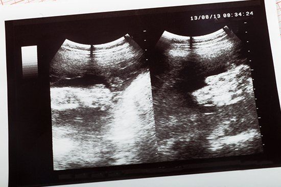 Sonohysterography — Ultrasound Scanner  in Manchester, NH