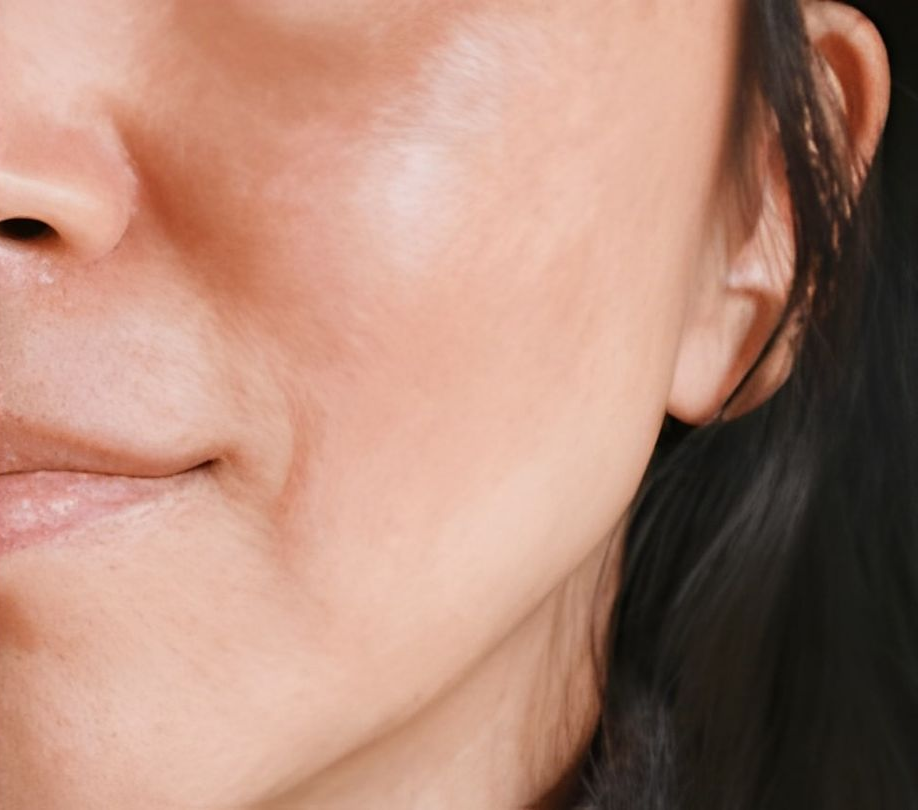 Featuring a Smooth Complexion, Dark Hair, and a Slight Smile — Bespoke Longevity and Aesthetic Medicine In Southport, QLD