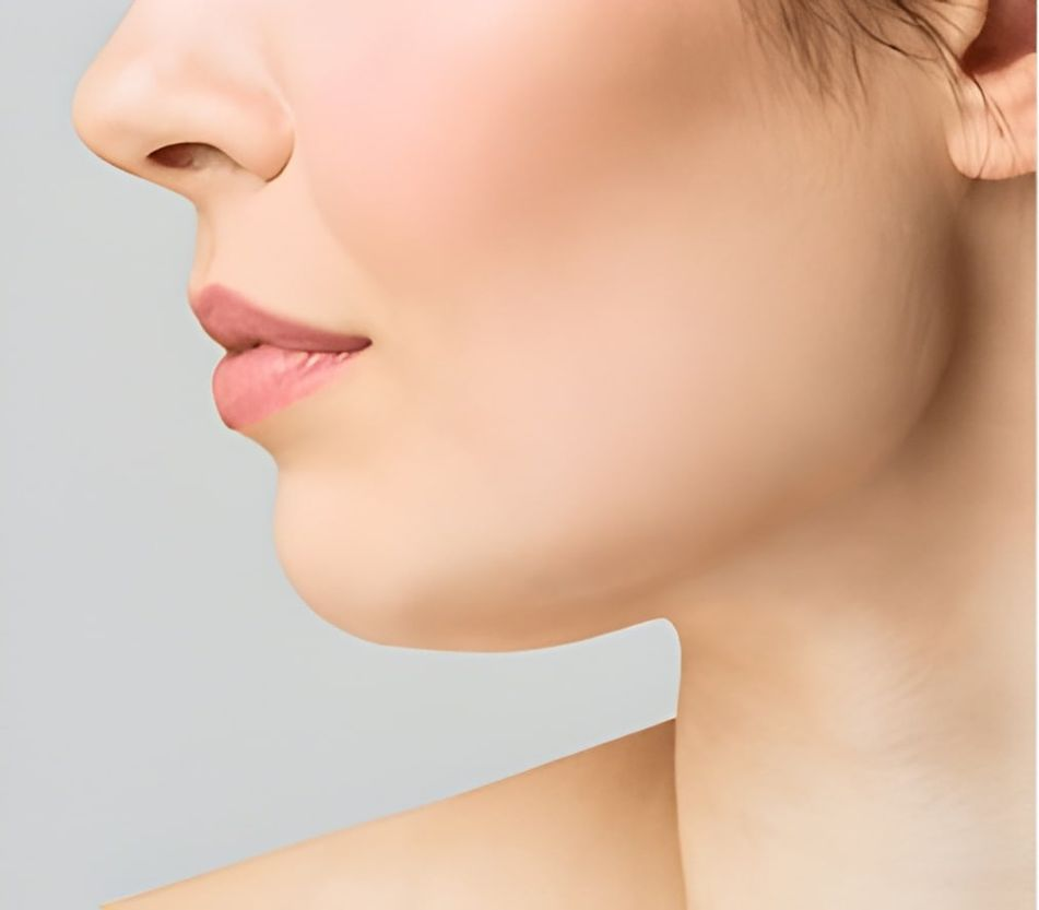 Side Profile of a Woman's Face and Fat Chin— Bespoke Longevity and Aesthetic Medicine In Southport, QLD