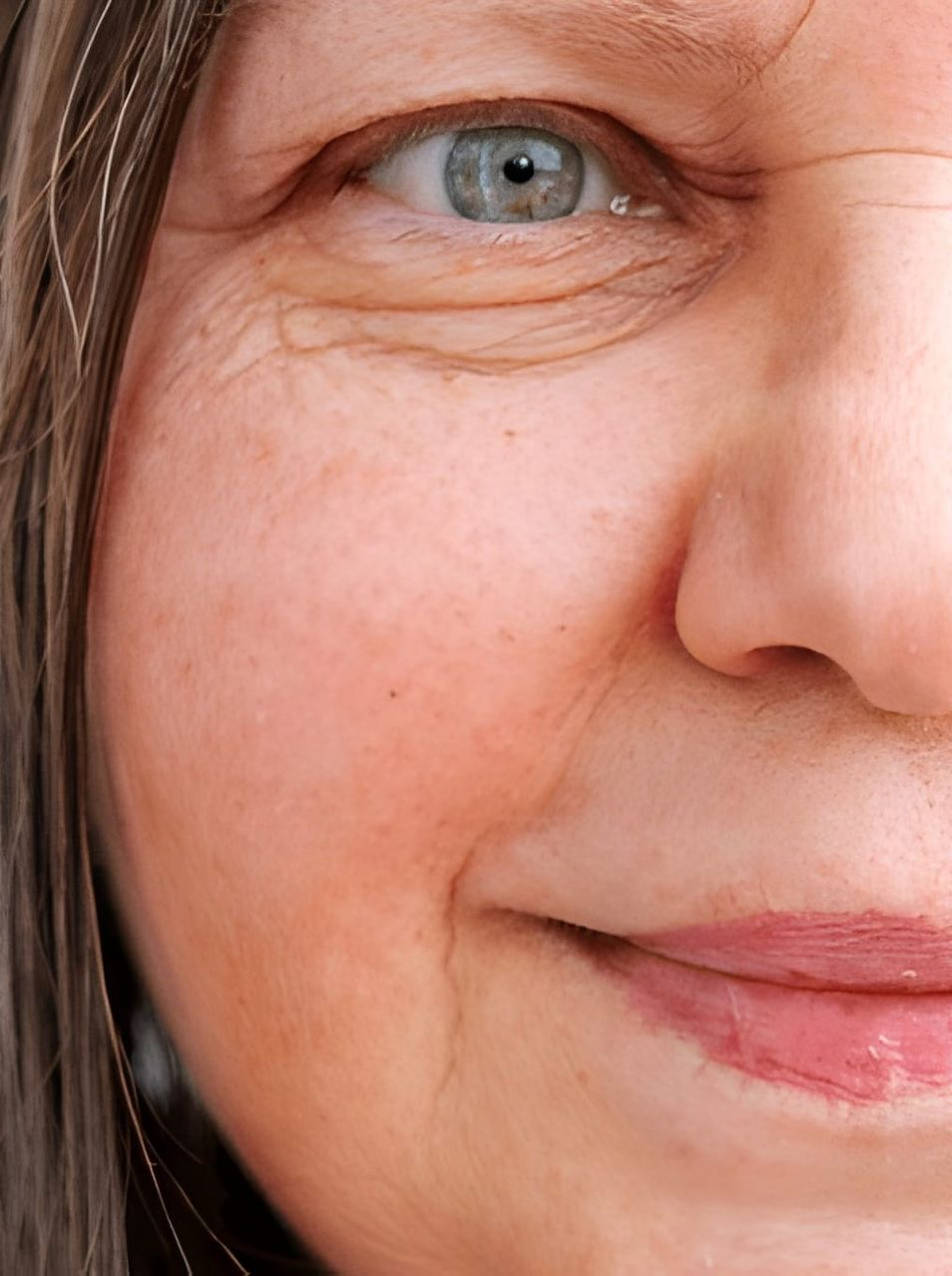 Close-up of woman's face with fair skin and showing wrinkles — Bespoke Longevity and Aesthetic Medicine In Southport, QLD