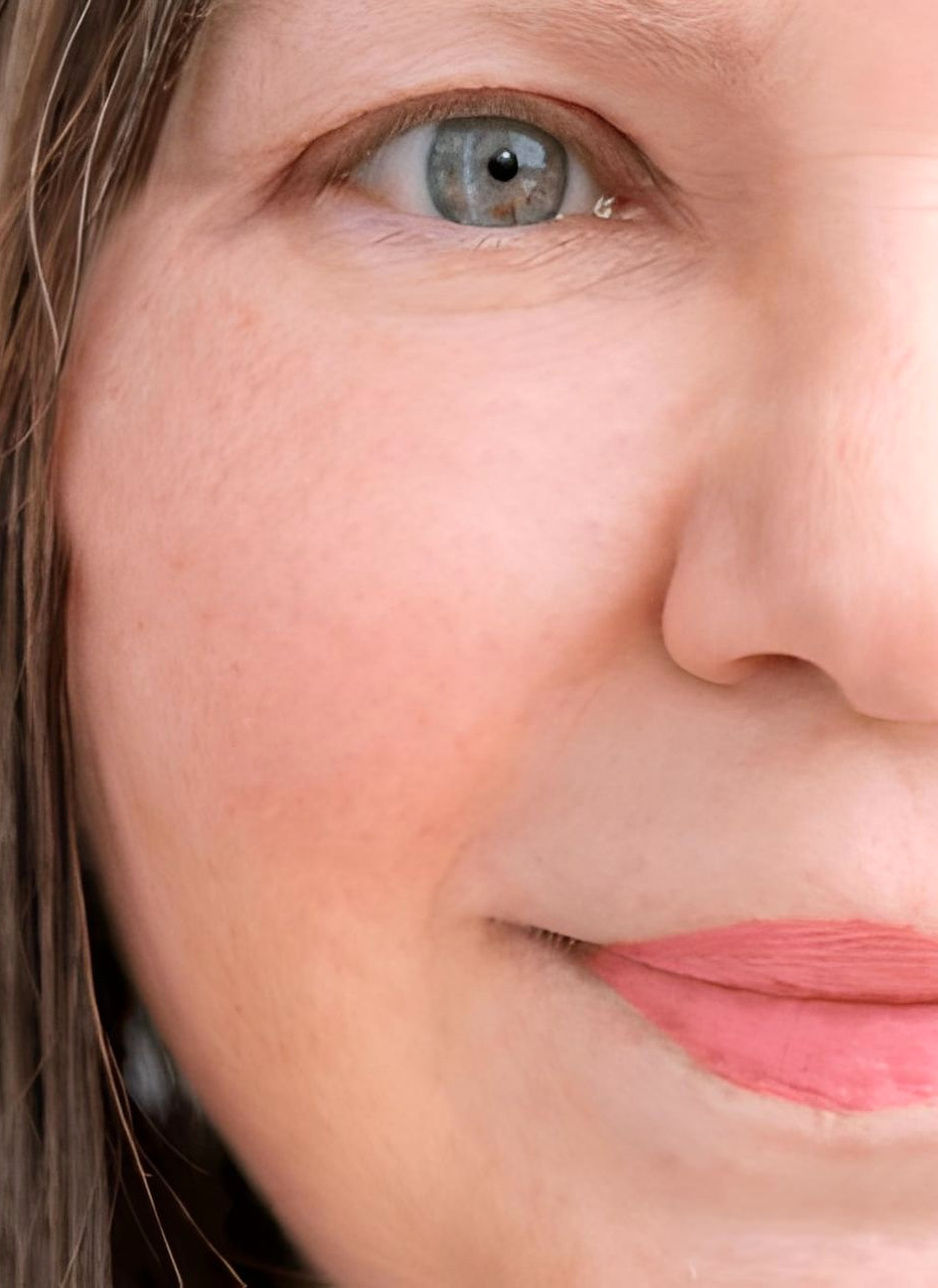 Close-Up of a Woman's Face With Smooth Face — Bespoke Longevity and Aesthetic Medicine In Southport, QLD