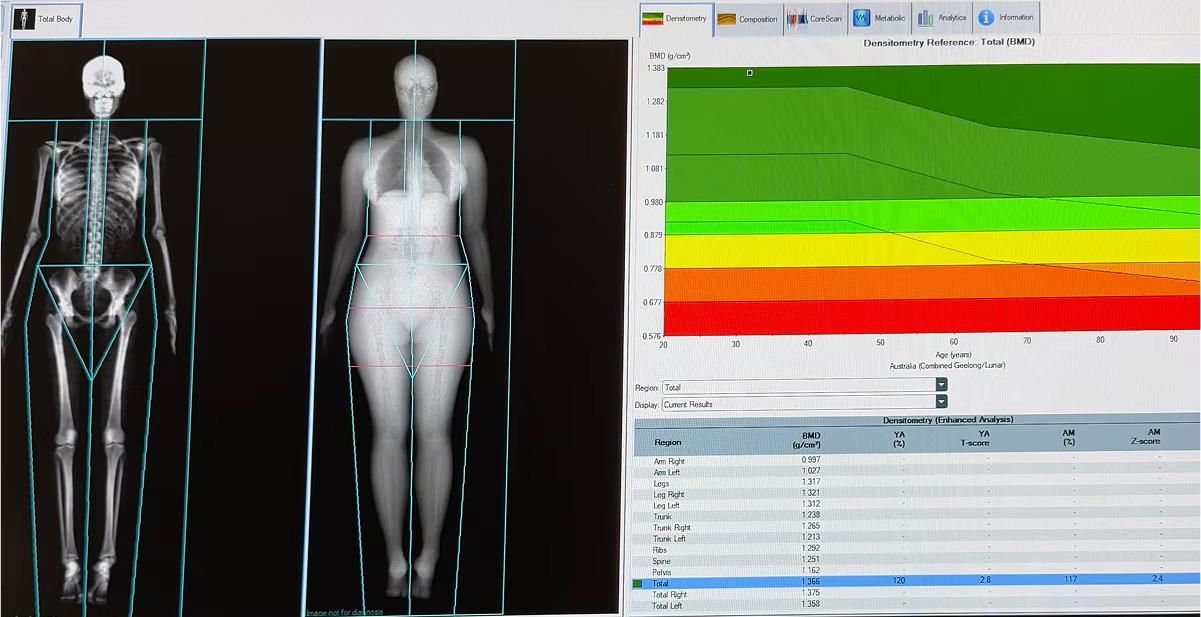 A Woman's Skeleton Is Shown Next to A Computer Screen with A Rainbow of Colors — Bespoke Institute In Southport, QLD