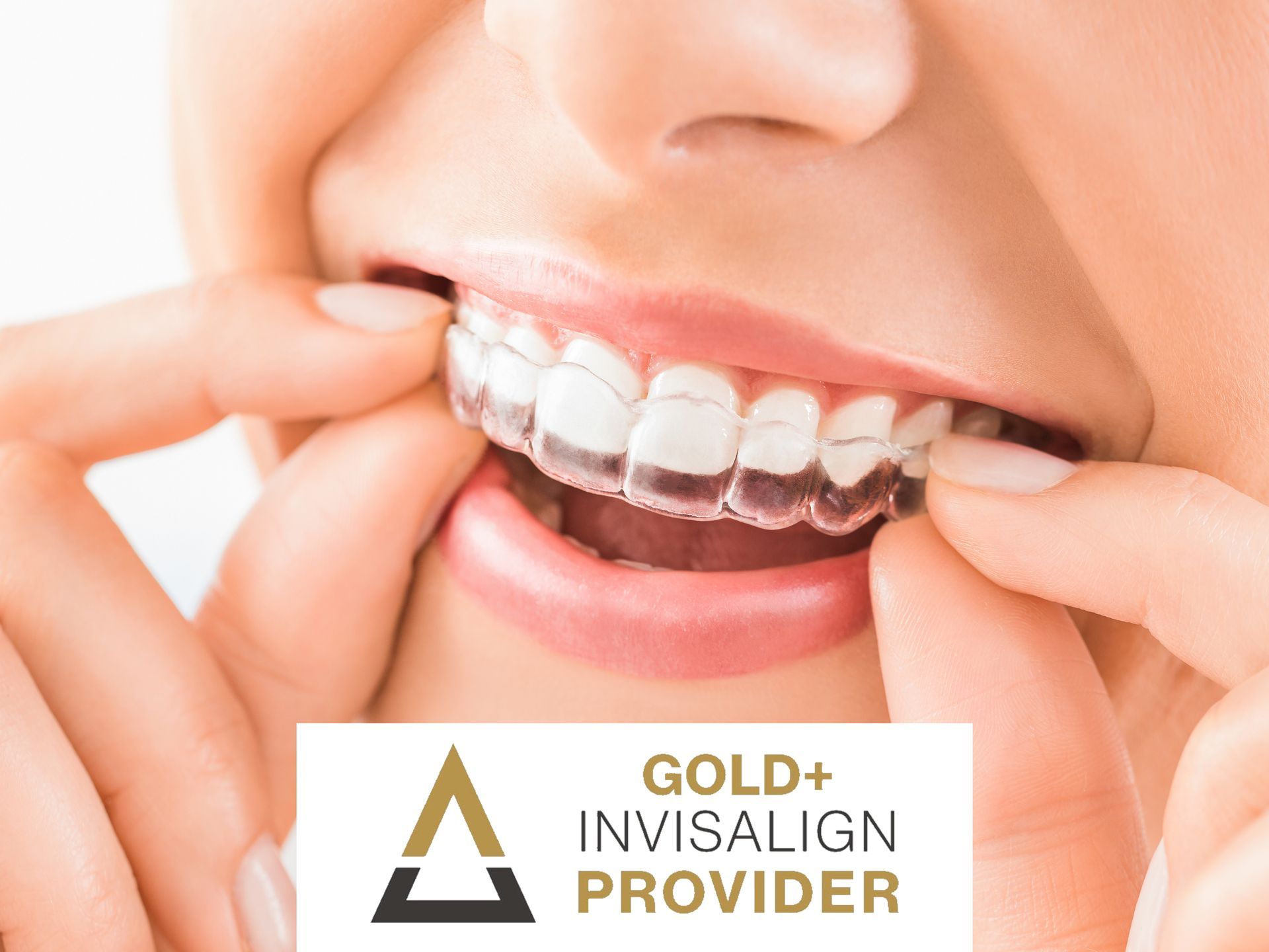 Woman inserting clear Invisalign aligner. Gold+ Invisalign Provider logo at the bottom.