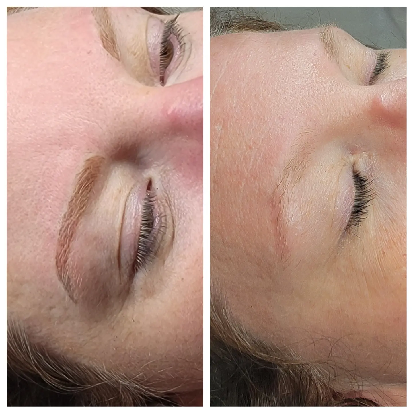 A before and after photo of a woman 's face with her eyes closed.