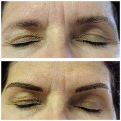A before and after photo of a woman 's eyebrows.
