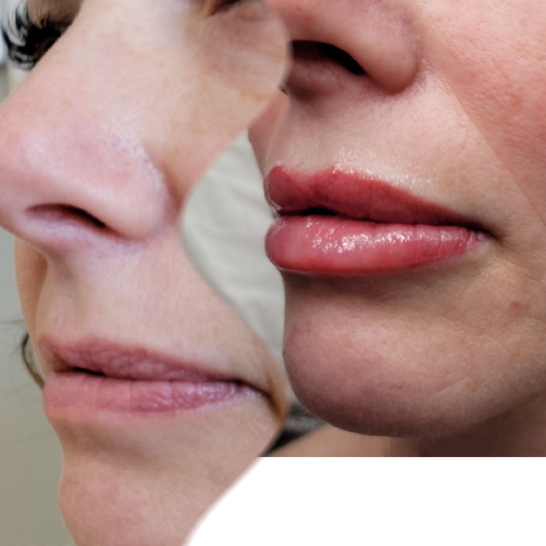 A close up of a woman 's nose and lips