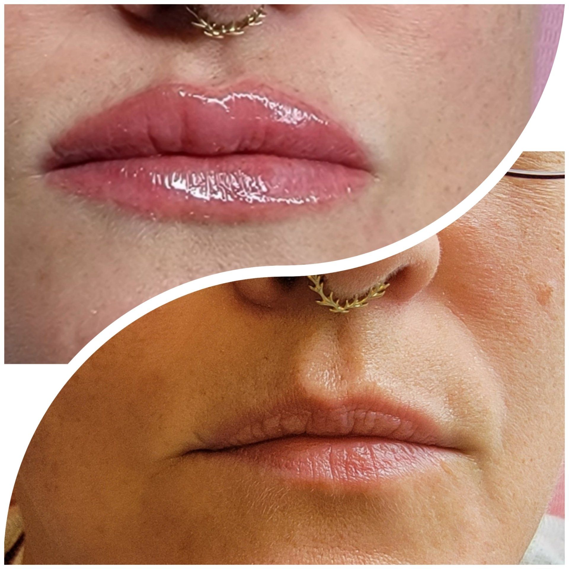 A before and after picture of a woman 's lips with a nose ring