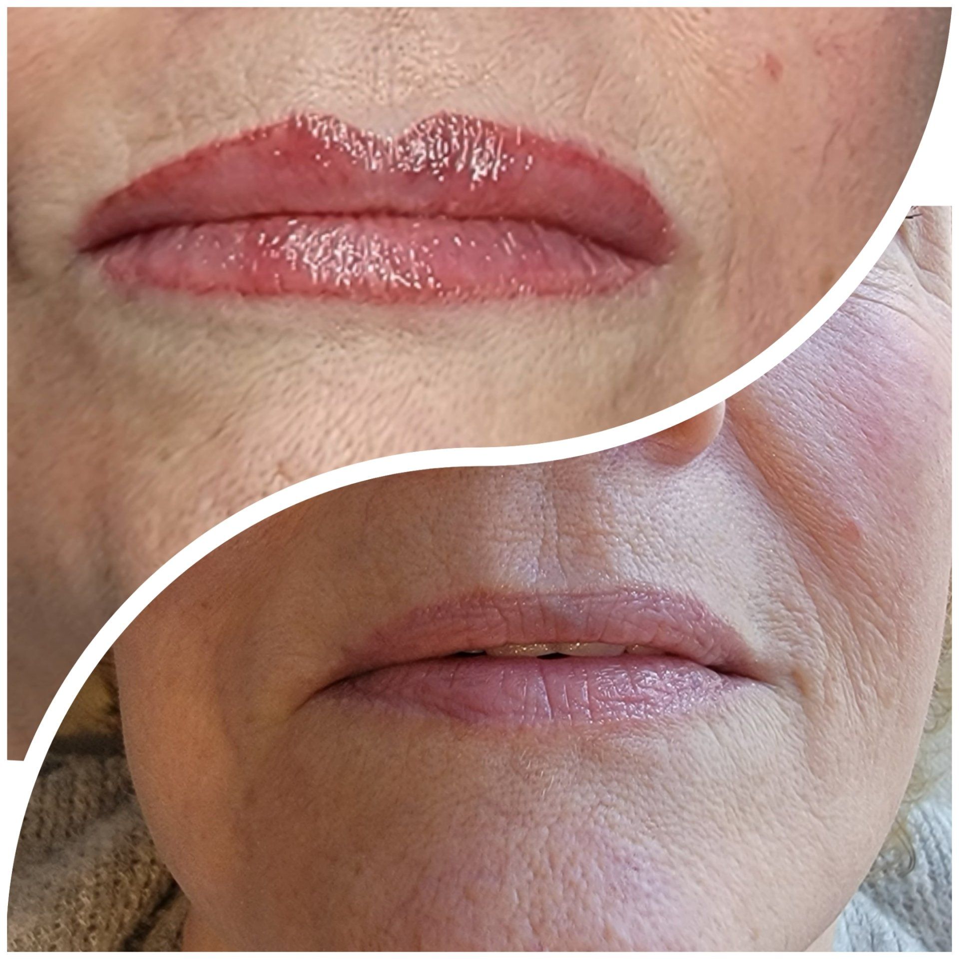 A before and after picture of a woman 's lips.