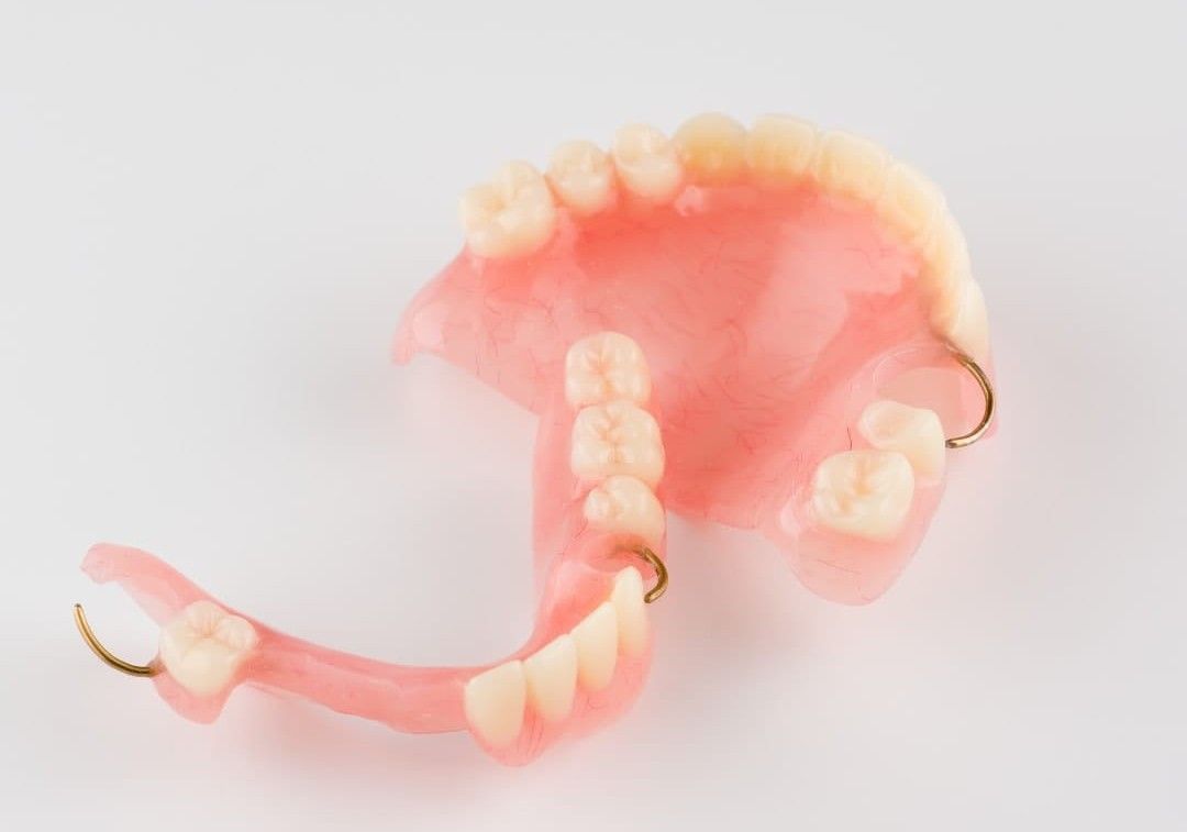 Studio Dentistico Murruni, Giussano, protesi dentale