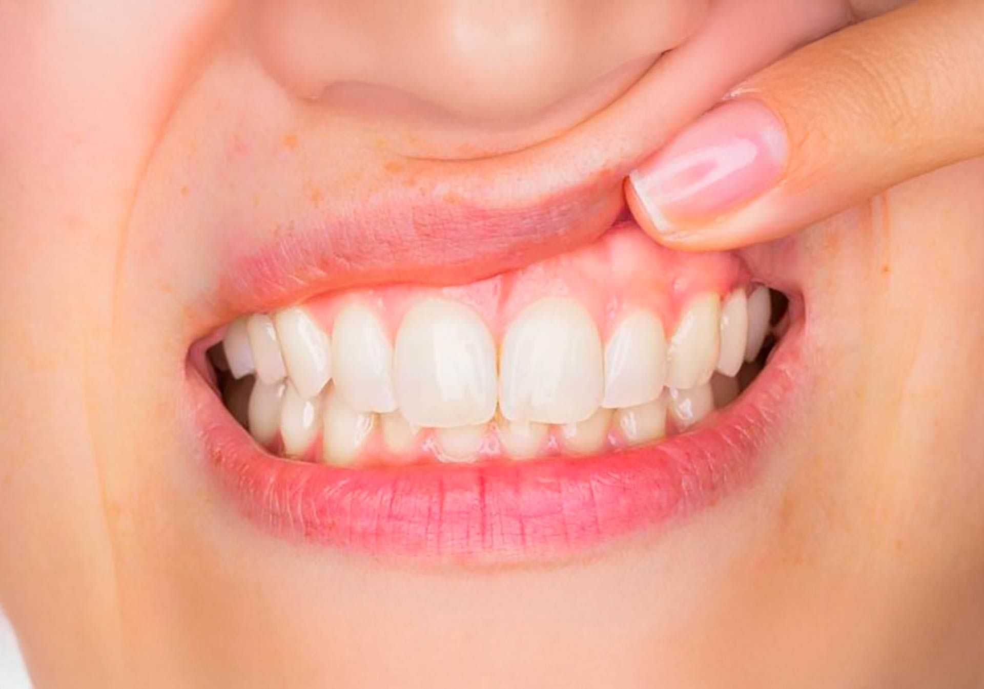 Studio Dentistico Murruni, Giussano, parodontologia