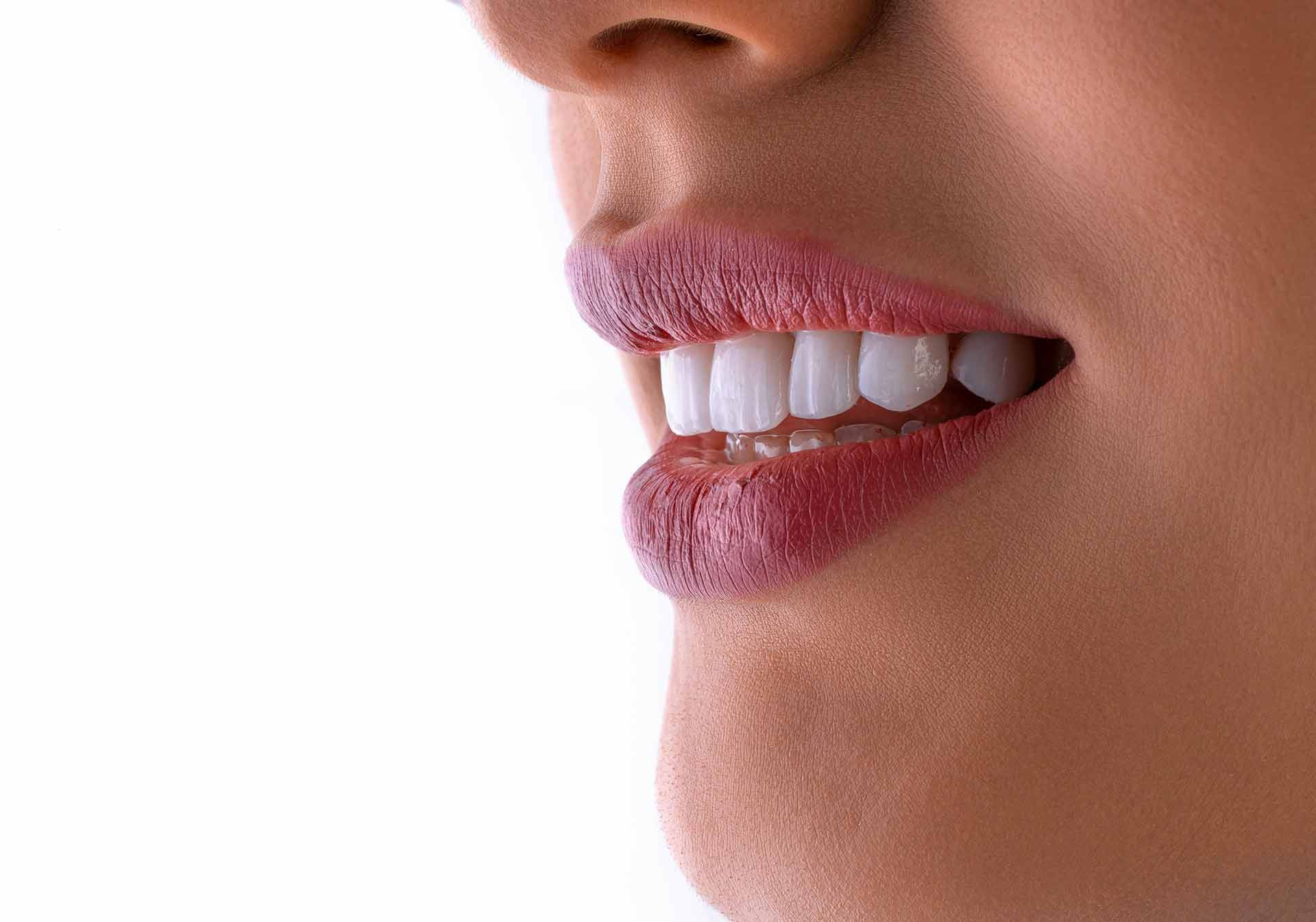 Studio Dentistico Murruni, Giussano, sbiancamento dentale