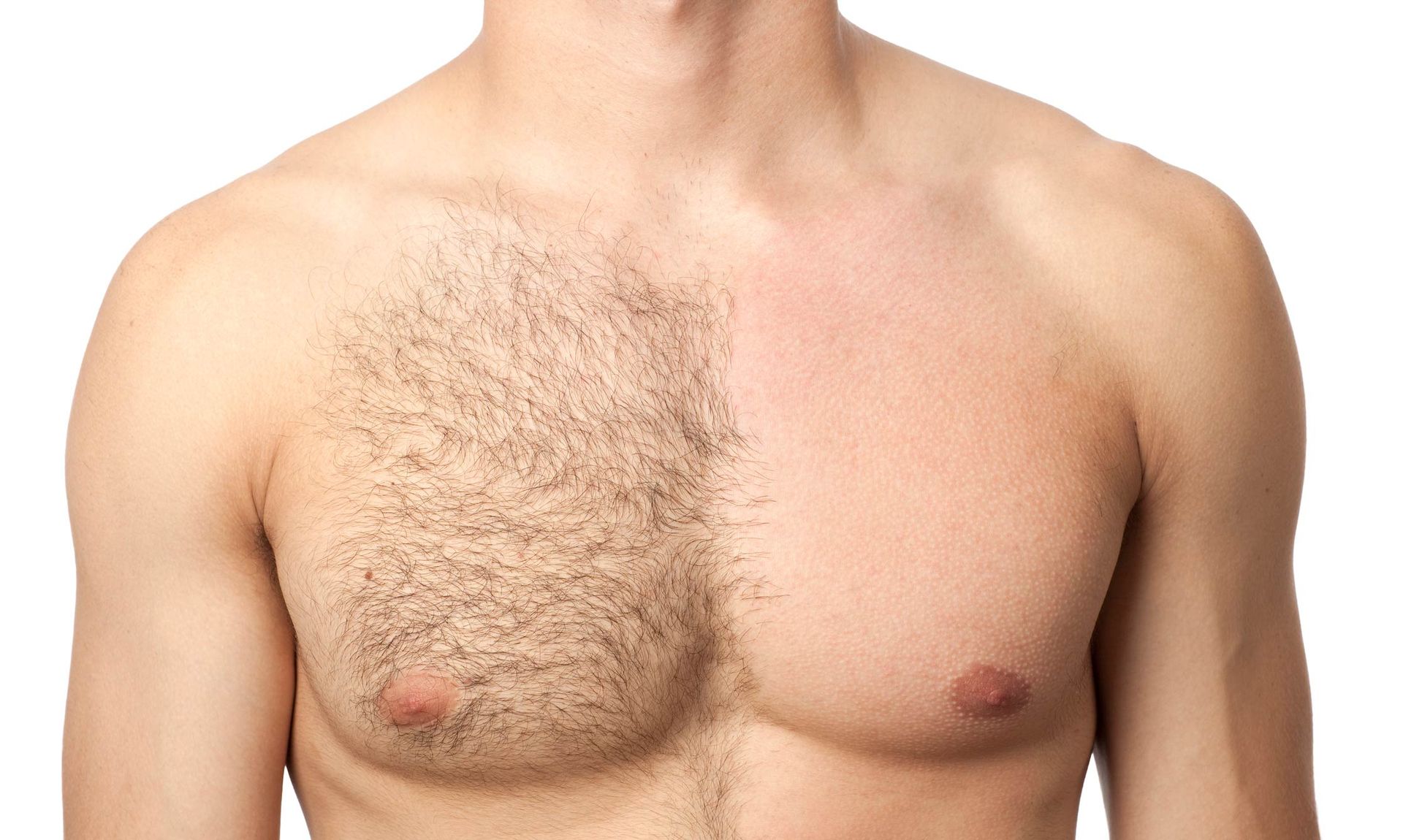Portrait Of Man Chest In Waxing Treatment — Centerville, OH — Elegant Permanent Cosmetics & Skincare