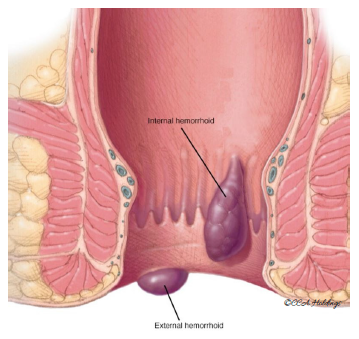 Ekstremal jinsiy pozitsiyalar