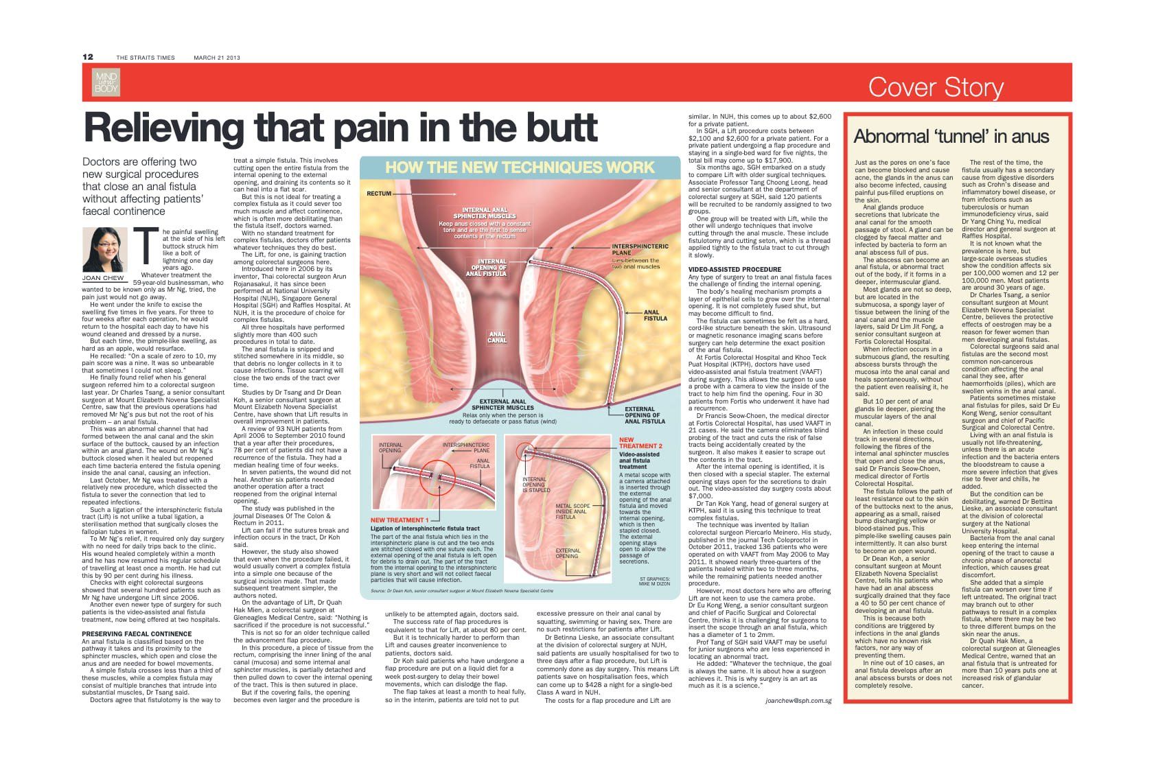 an article about anal fistula surgery in Singapore