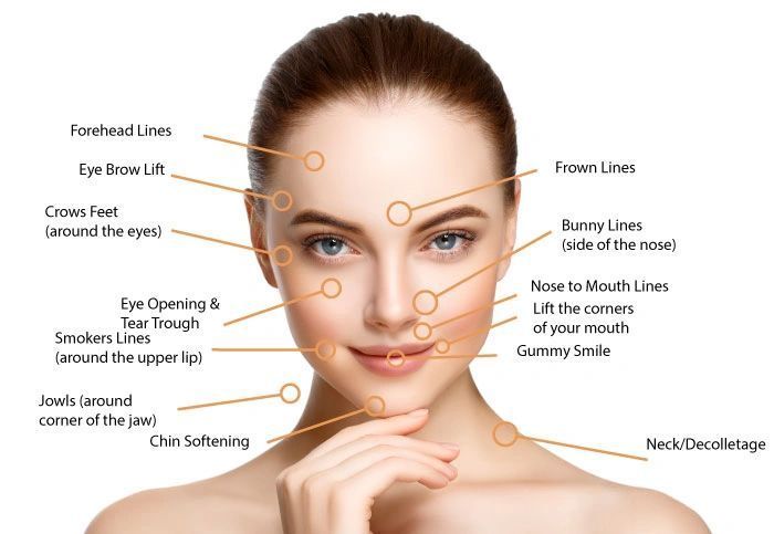 Botox Treatment Areas of The Face and Neck