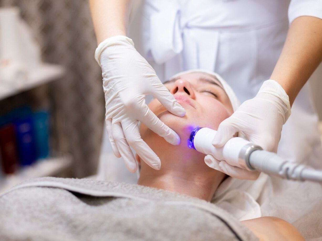 Laser Therapy for Sun Spots