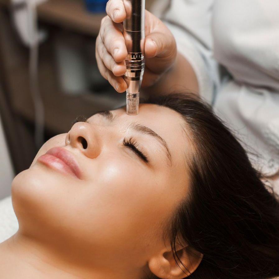 Microneedling Treatment for smooth, radiant skin.