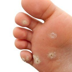foot disorder