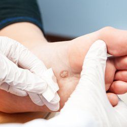 foot treatments 