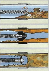 rimozione ostruzione