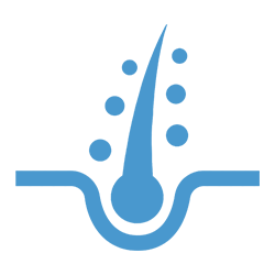 Soluzioni per la calvizie