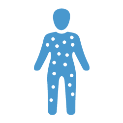 Diagnosi e trattamento tumori della pelle