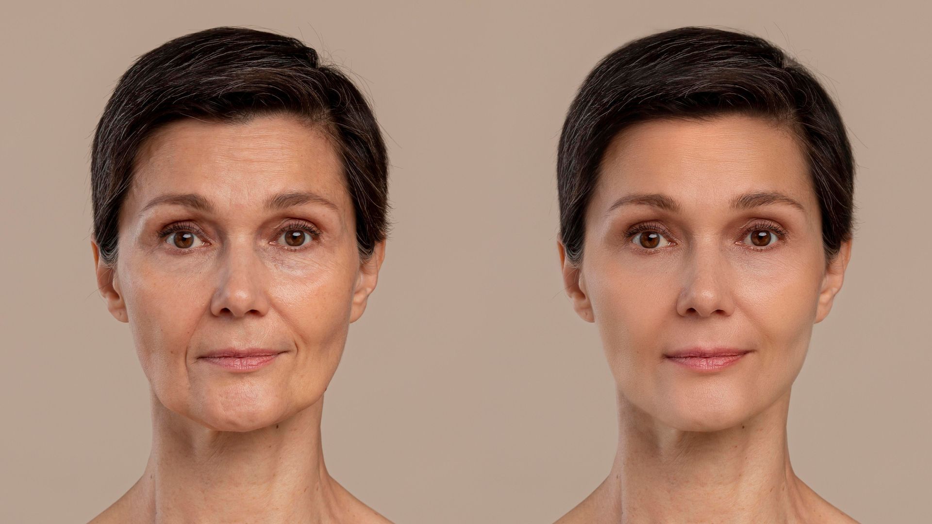 a before and after photo of a woman 's face .