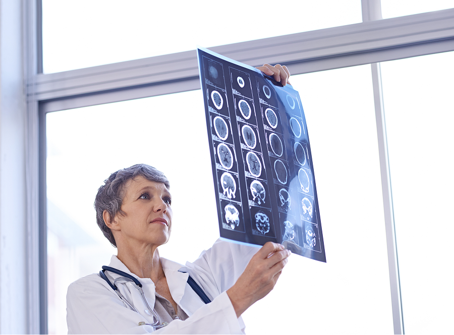 A doctor is looking at an x-ray of a person 's head.