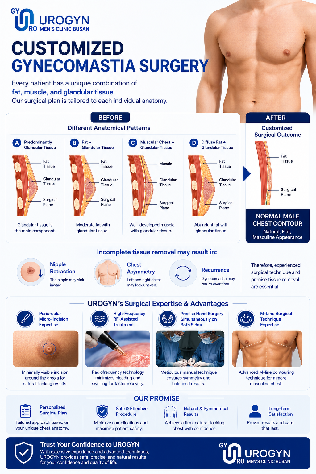 Gynecomastia surgery procedure at Urogyn Busan Seomyeon