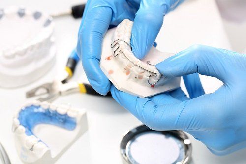 Preparando la ortodonzia con l'aiuto degli stampi