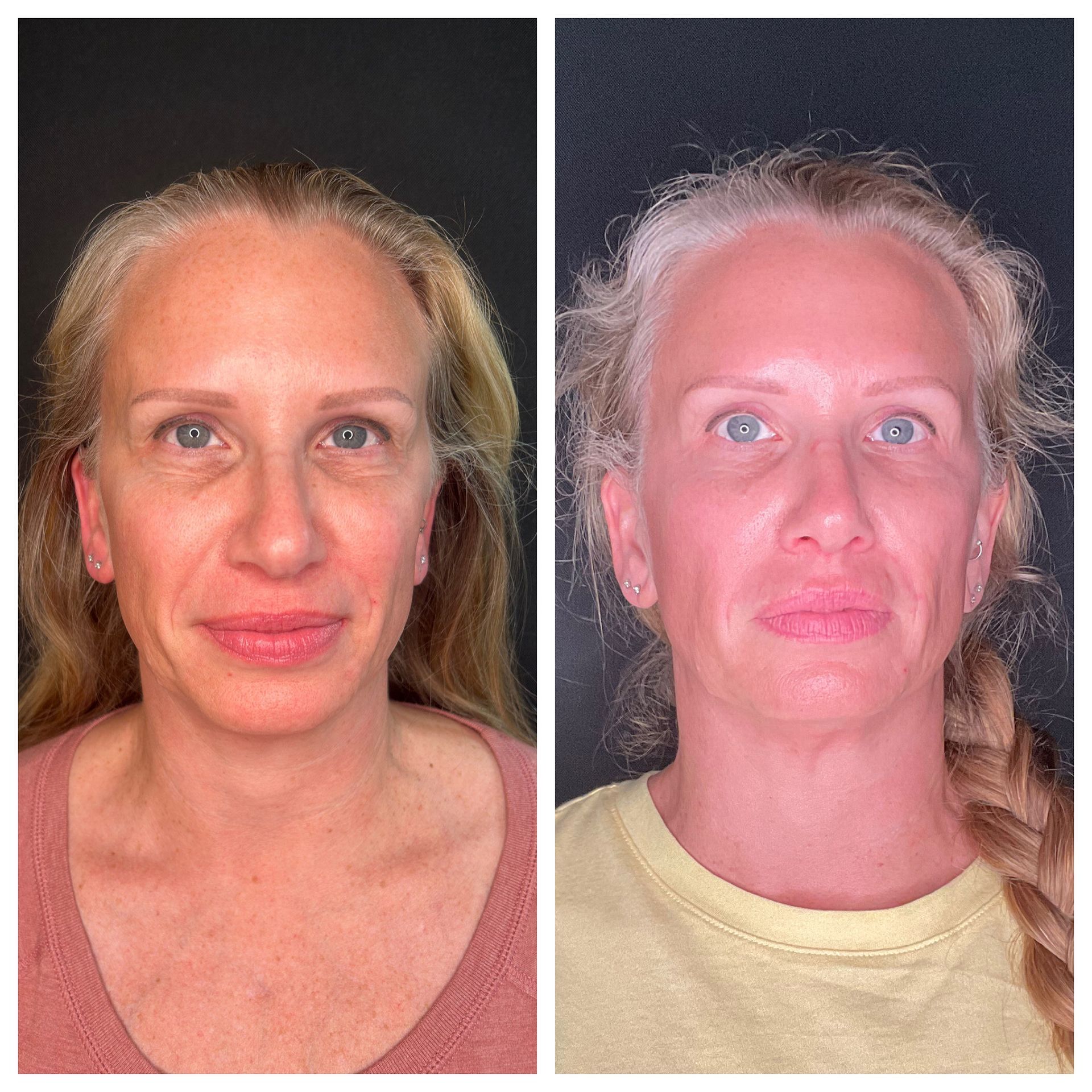 A before and after photo of a woman 's face.