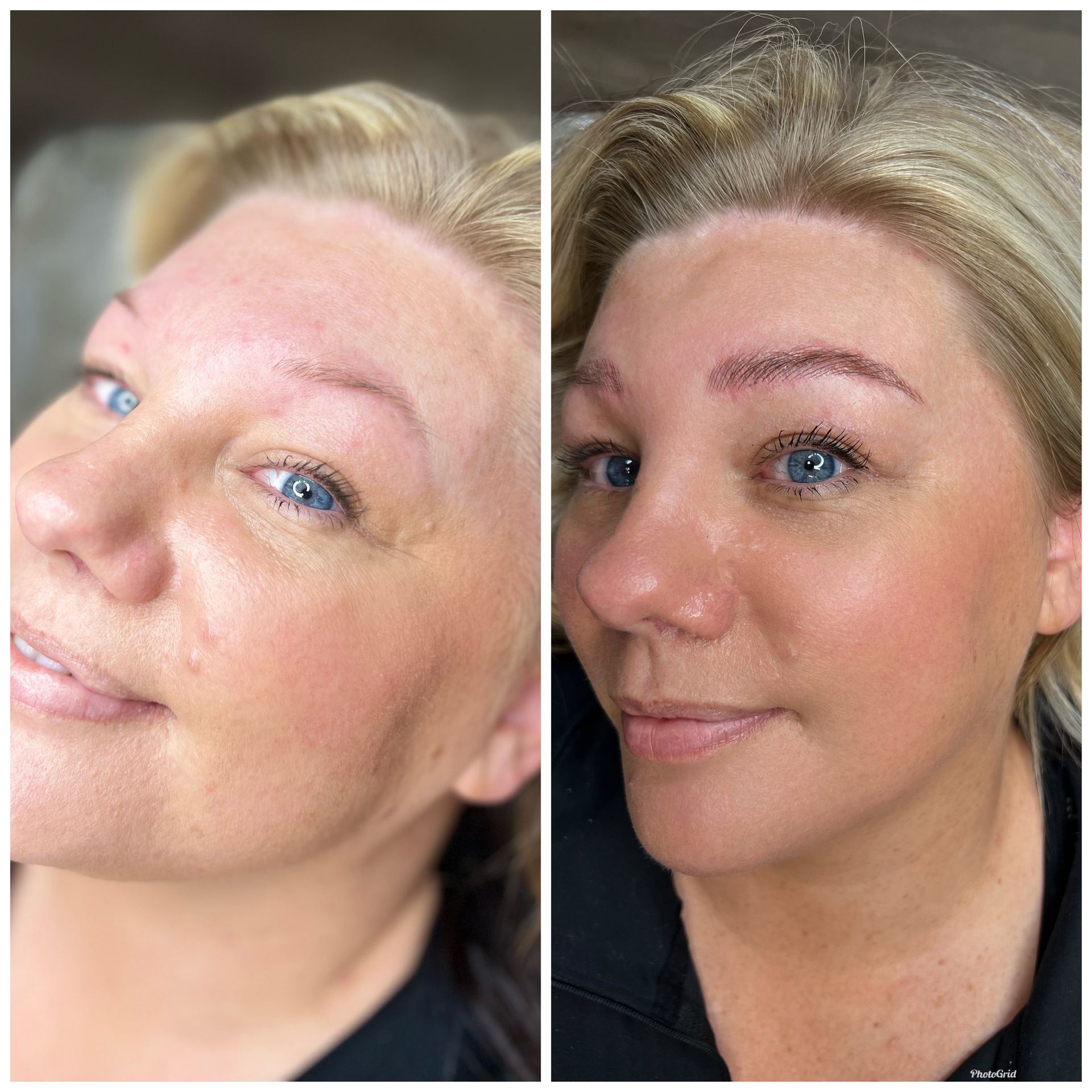 A before and after photo of a woman 's face.