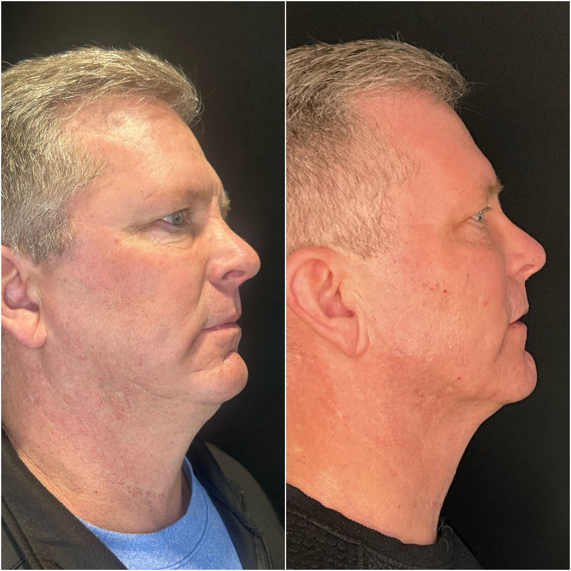 A before and after photo of a man 's face