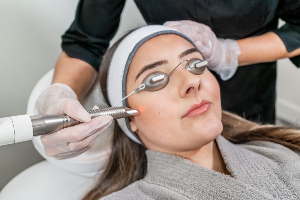 Woman receiving laser facial treatment, wearing protective eyewear and headband, with a gloved technician.