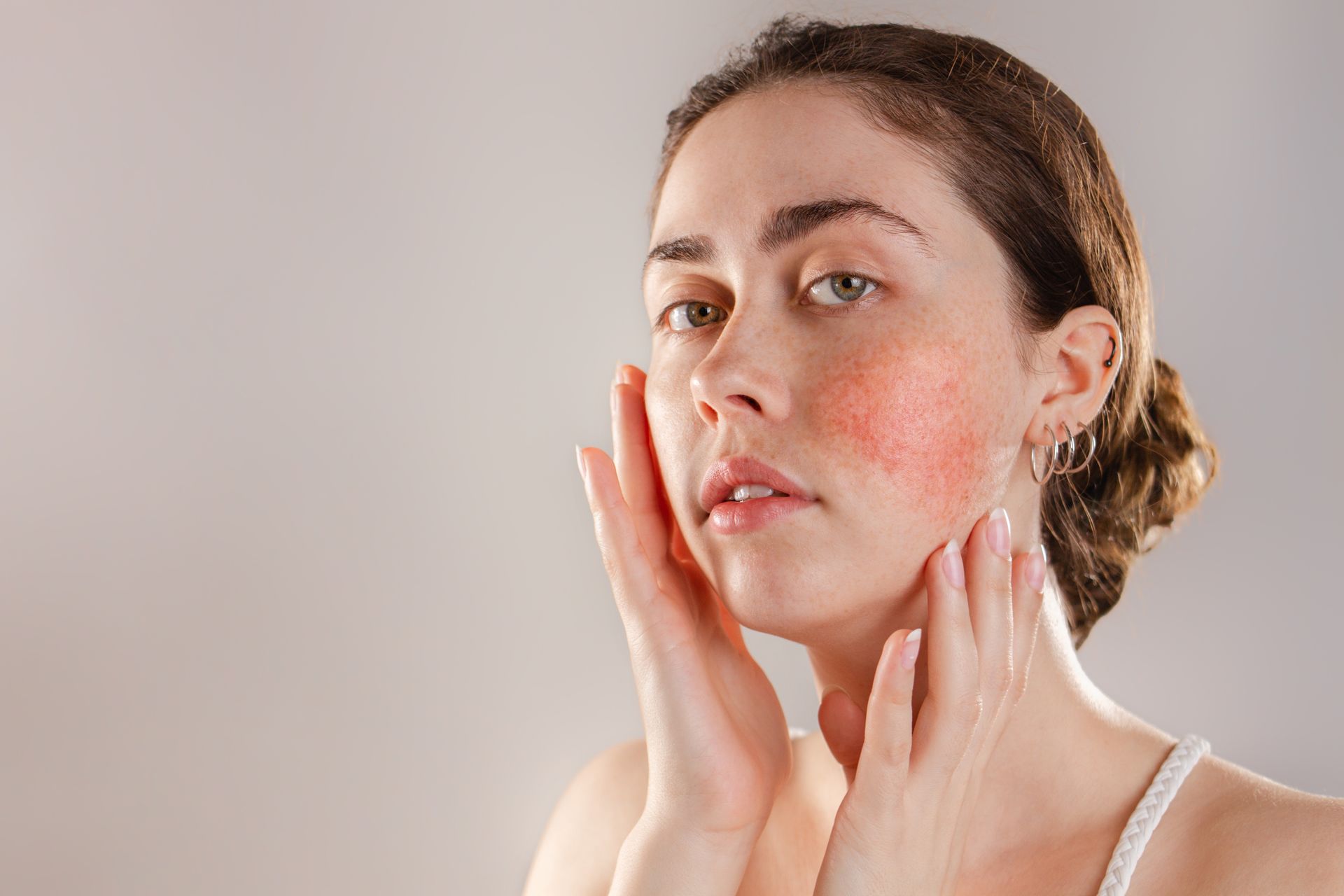 Woman with visible facial redness, touching cheeks and neck against a neutral background.
