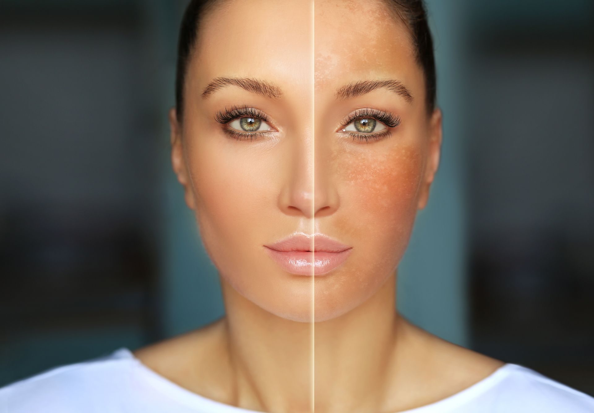 Face with uneven skin tone, lighter on left, darker with brown spots on right.