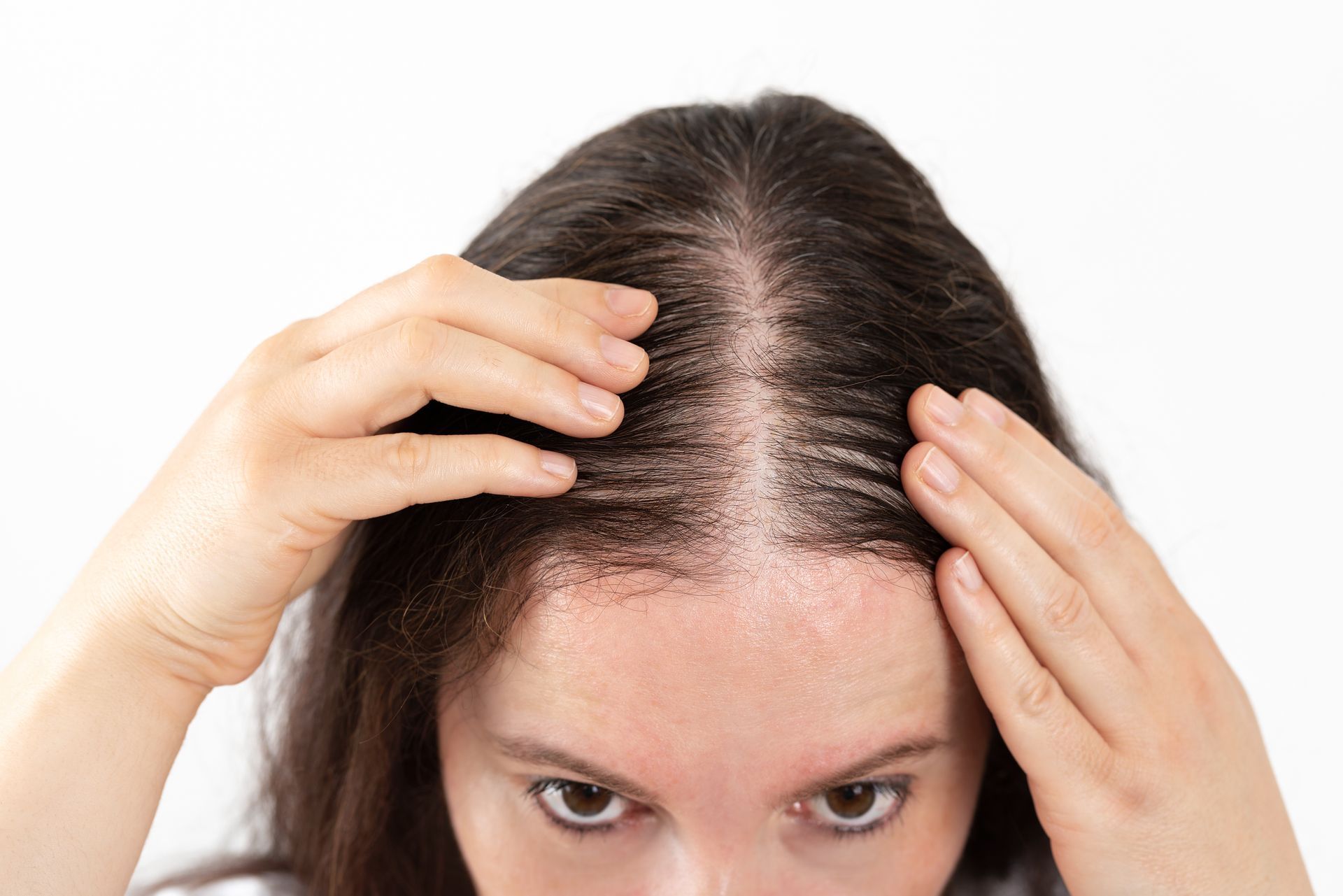 Woman examining scalp for hair loss. Brown hair, visible scalp, indoor setting.