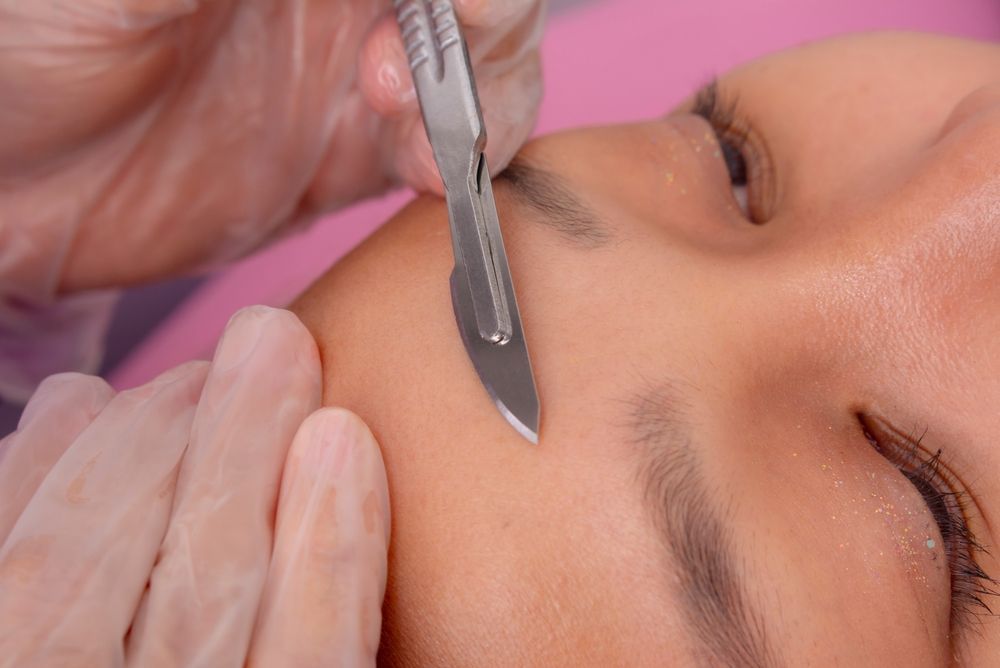Person's face with a scalpel on their skin, likely for a dermaplaning procedure.