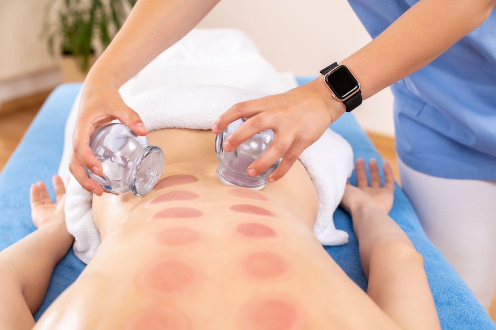 A Woman is Getting a Cupping Treatment on Her Back — Kerry's Body Therapy in Millner, NT