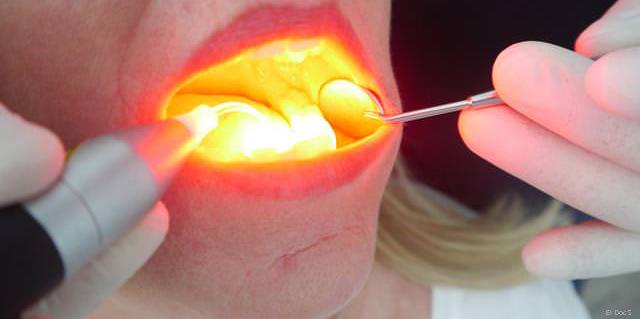 Wirksame Beseitigung krankmachender Mund-Bakterien