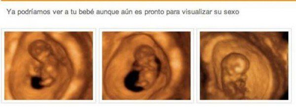 Centro de Medicina Fetal, consultorio especializado en ginecología y obstetricia en Trujillo.