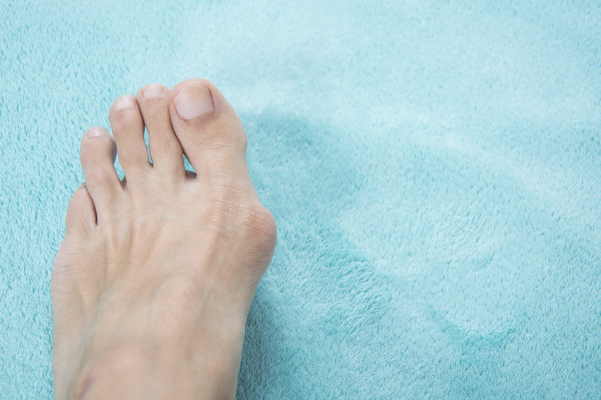 Foot Doctor for Bunions
