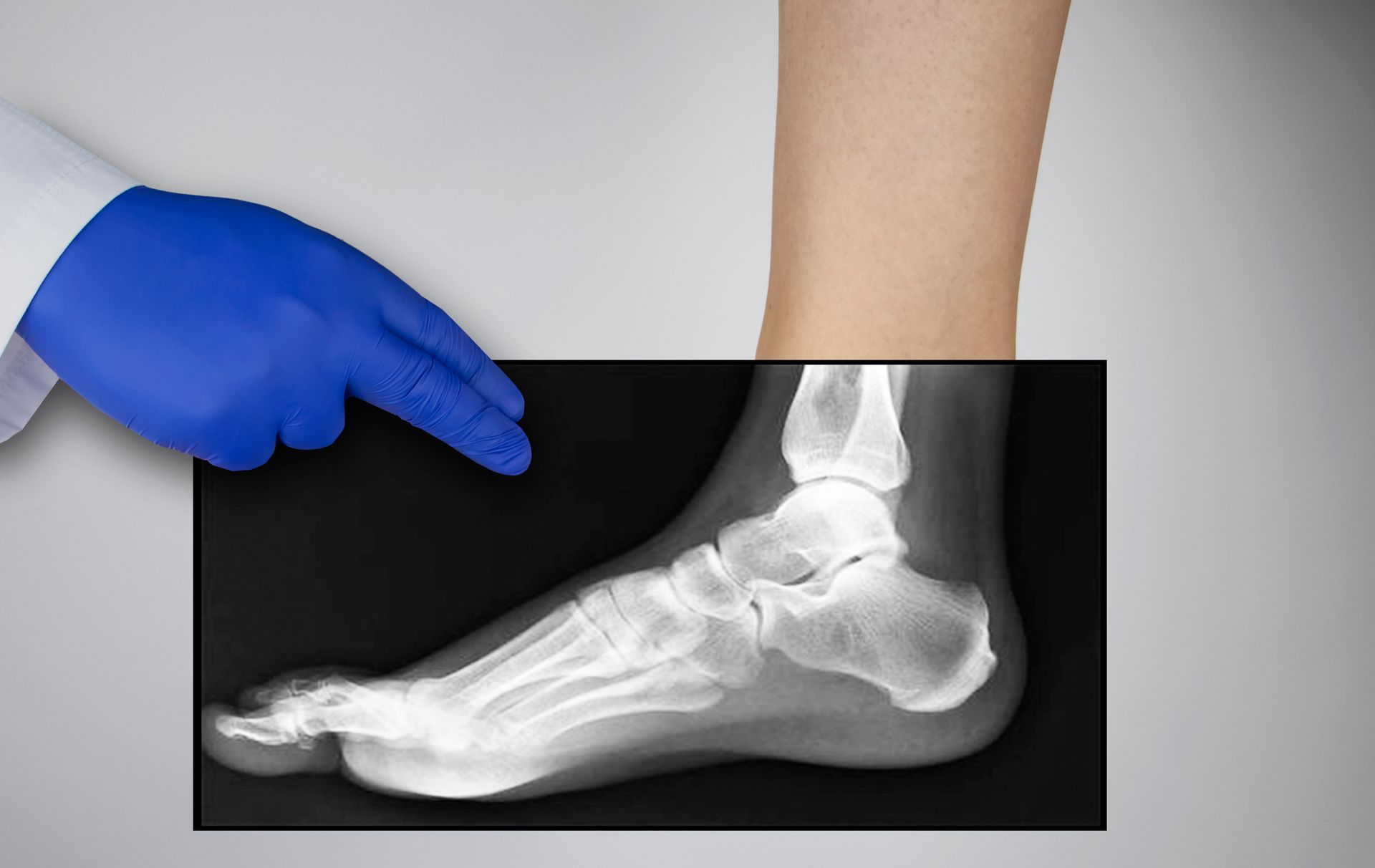 Foot & Ankle Procedures
