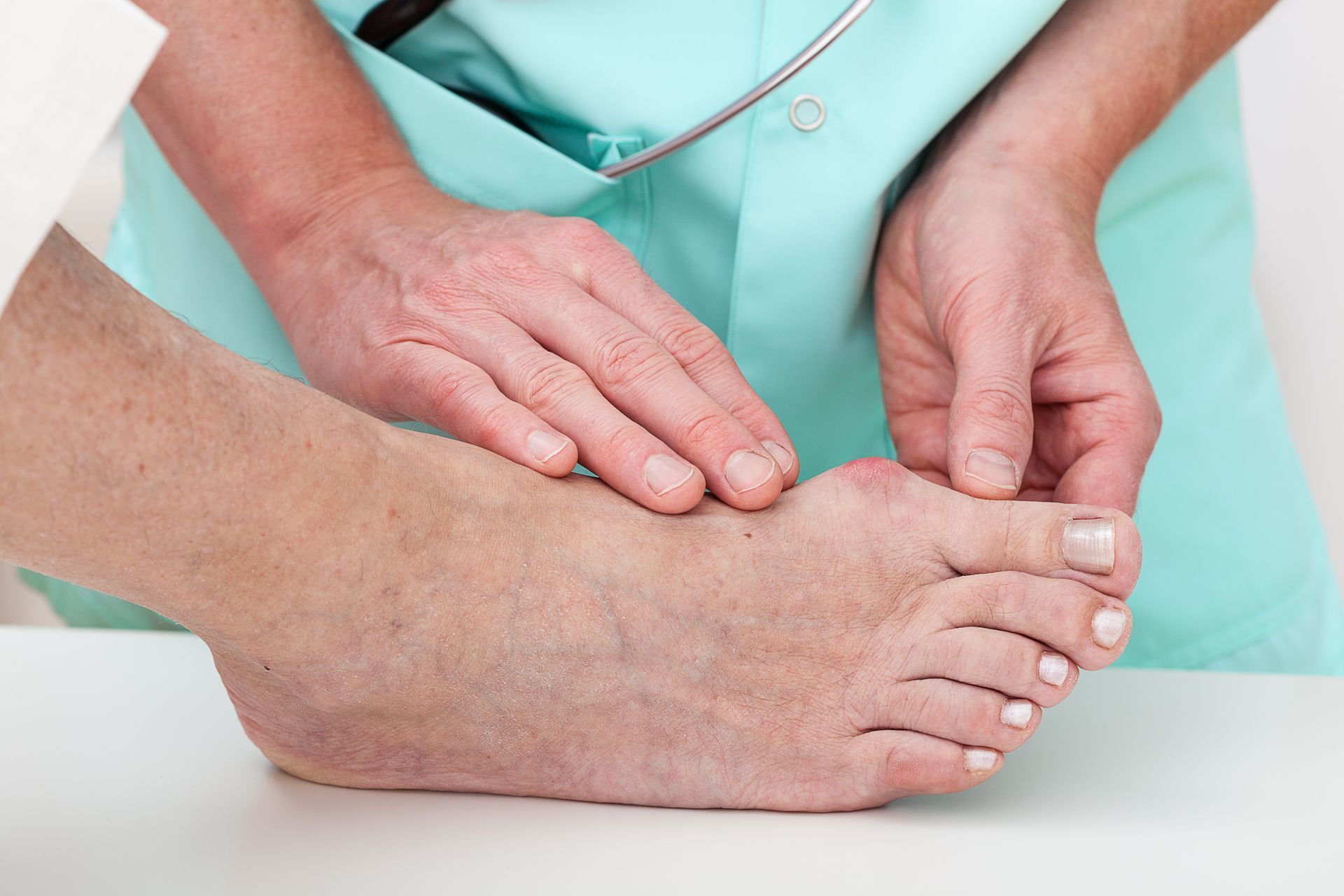 Doctor examining bunion