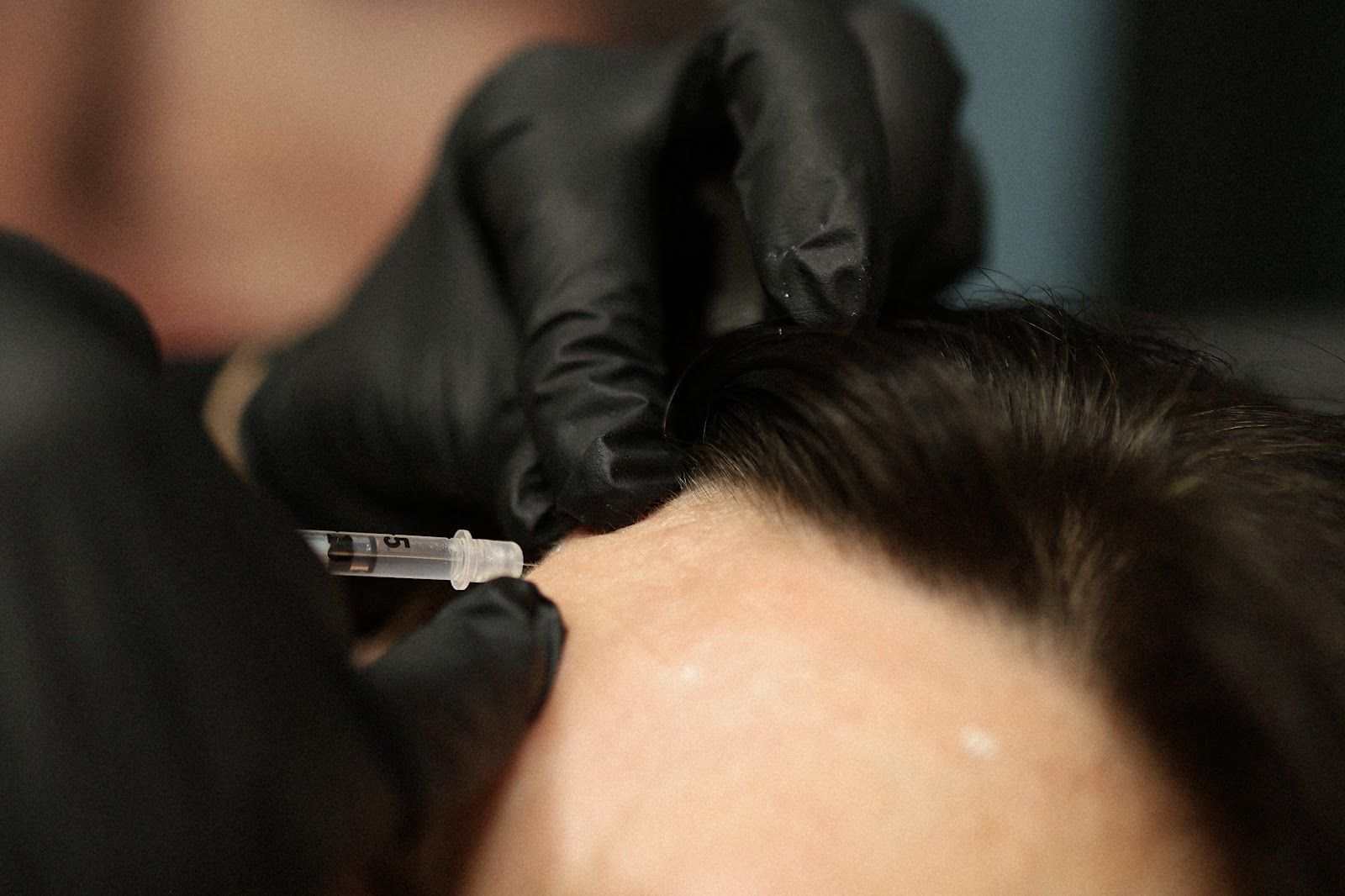 Close-up of a person in black gloves administering an injection into a patient's forehead.