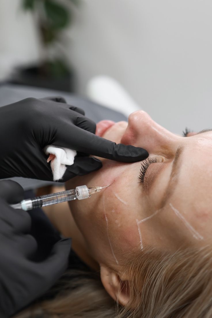 Person receiving facial injections; doctor with black gloves holds syringe, skin marked with lines.